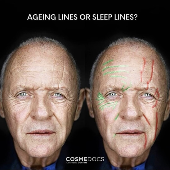 Aging Lines Vs. Sleeping Lines